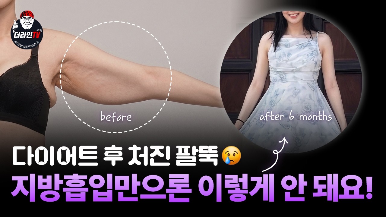 Quick Body Shaping – Ssak Injection