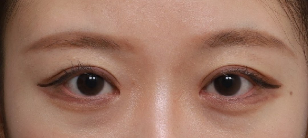 After